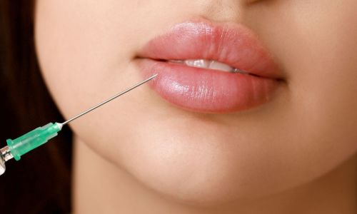 Filler Labbra Bergamo