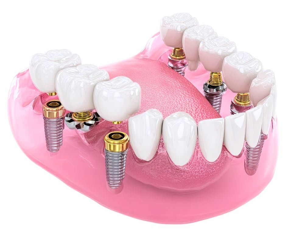 conservativa dentale