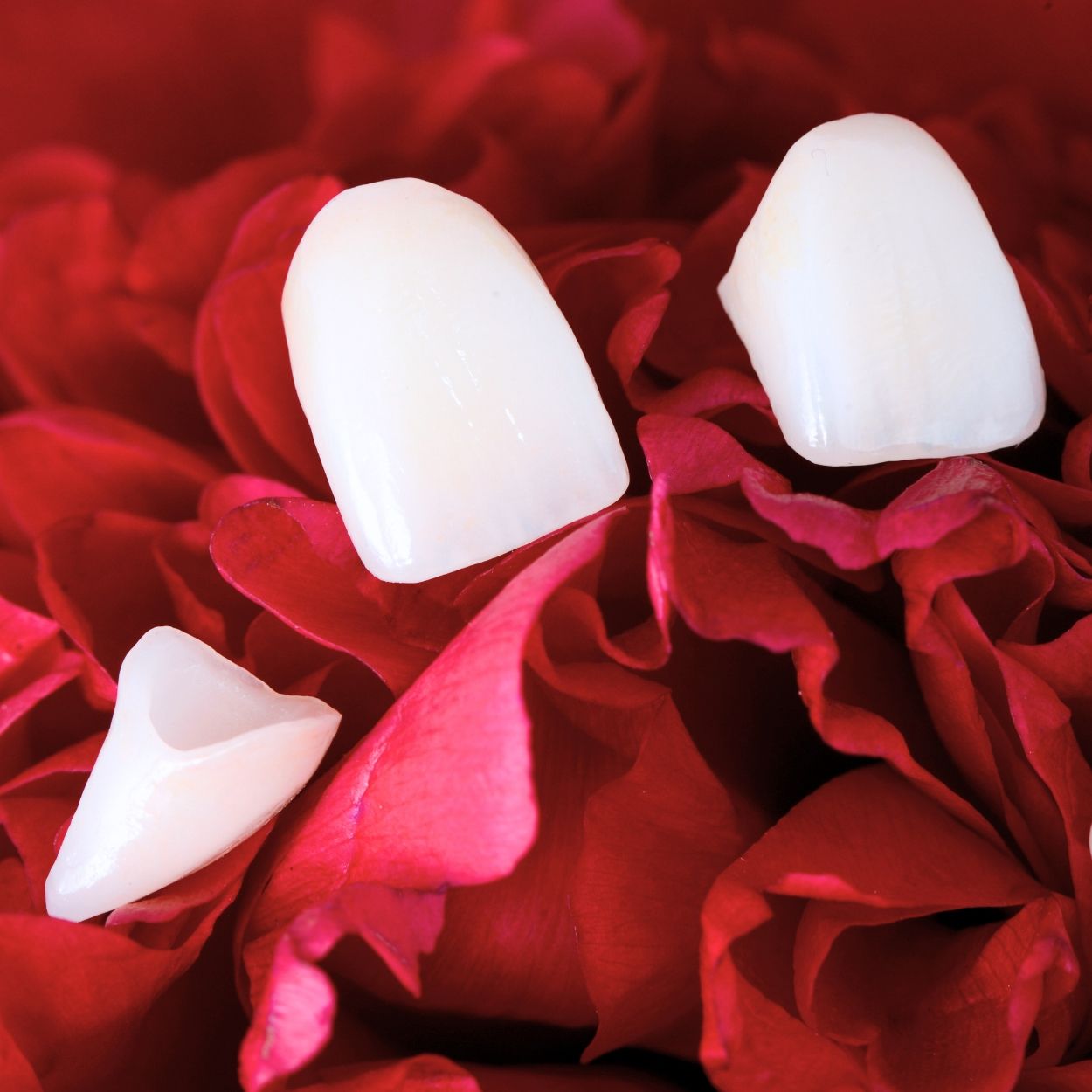 faccette dentali