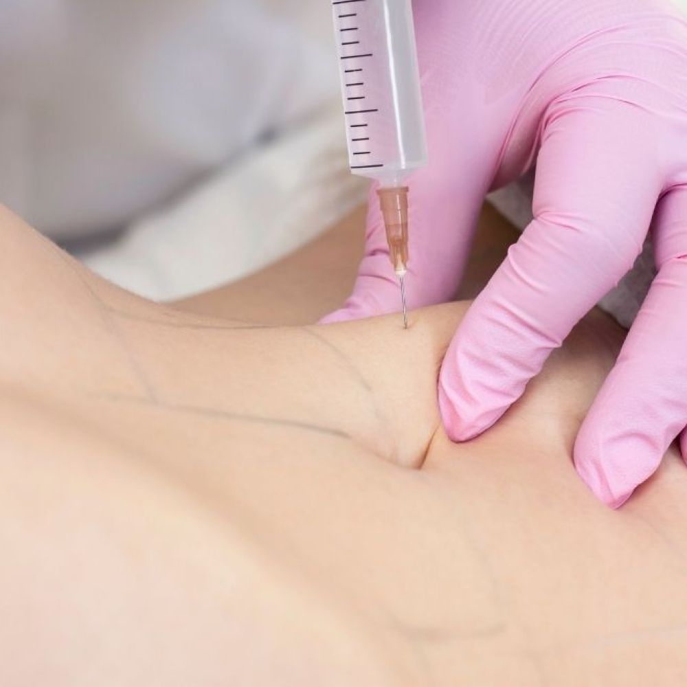 liposcultura addome