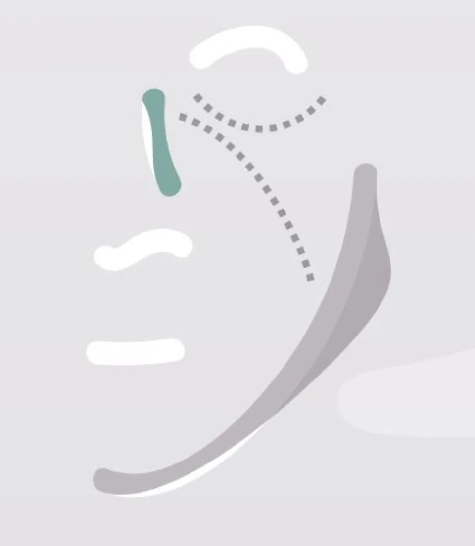 Trattamenti chirurgici avanzati al viso