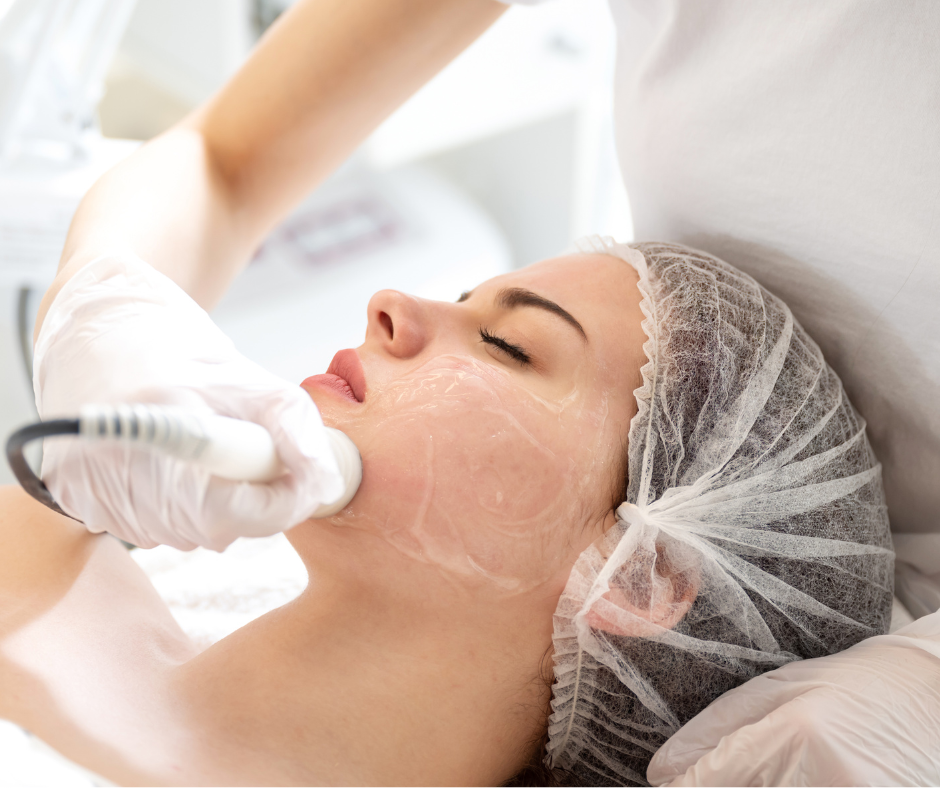laser per le cicatrici acne