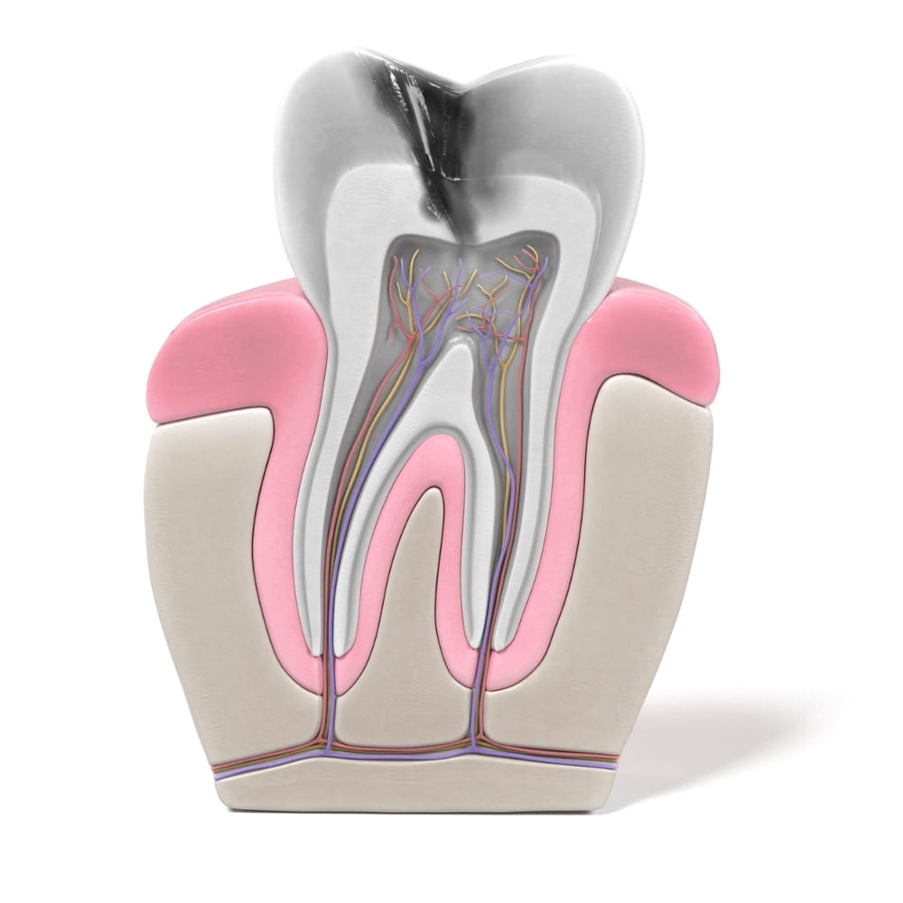 endodonzia