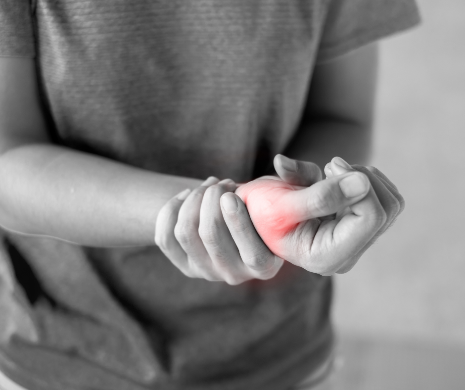 De Quervain intervento