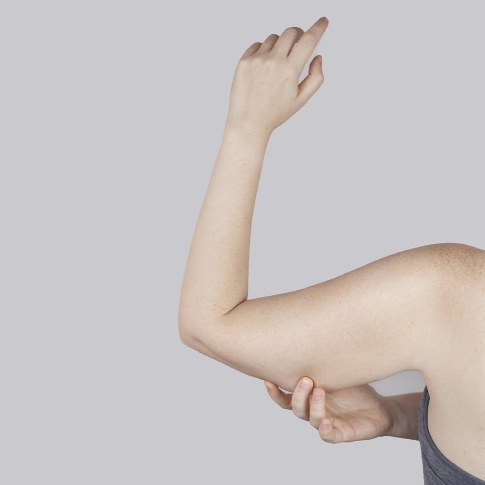 Brachioplastica lipofilling bergamo