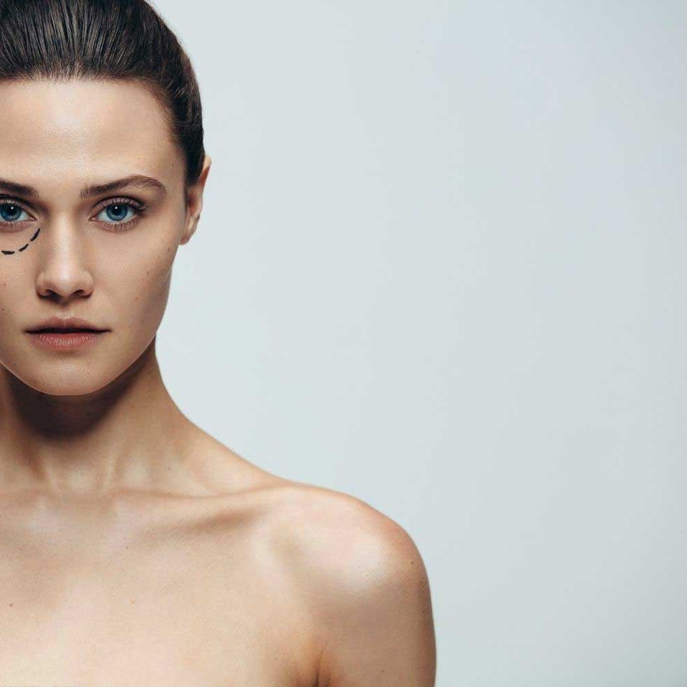 Trattamenti avanzati occhi